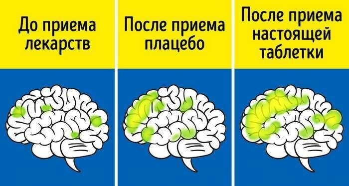 Как работает эффект плацебо - 20.08.24 12:02